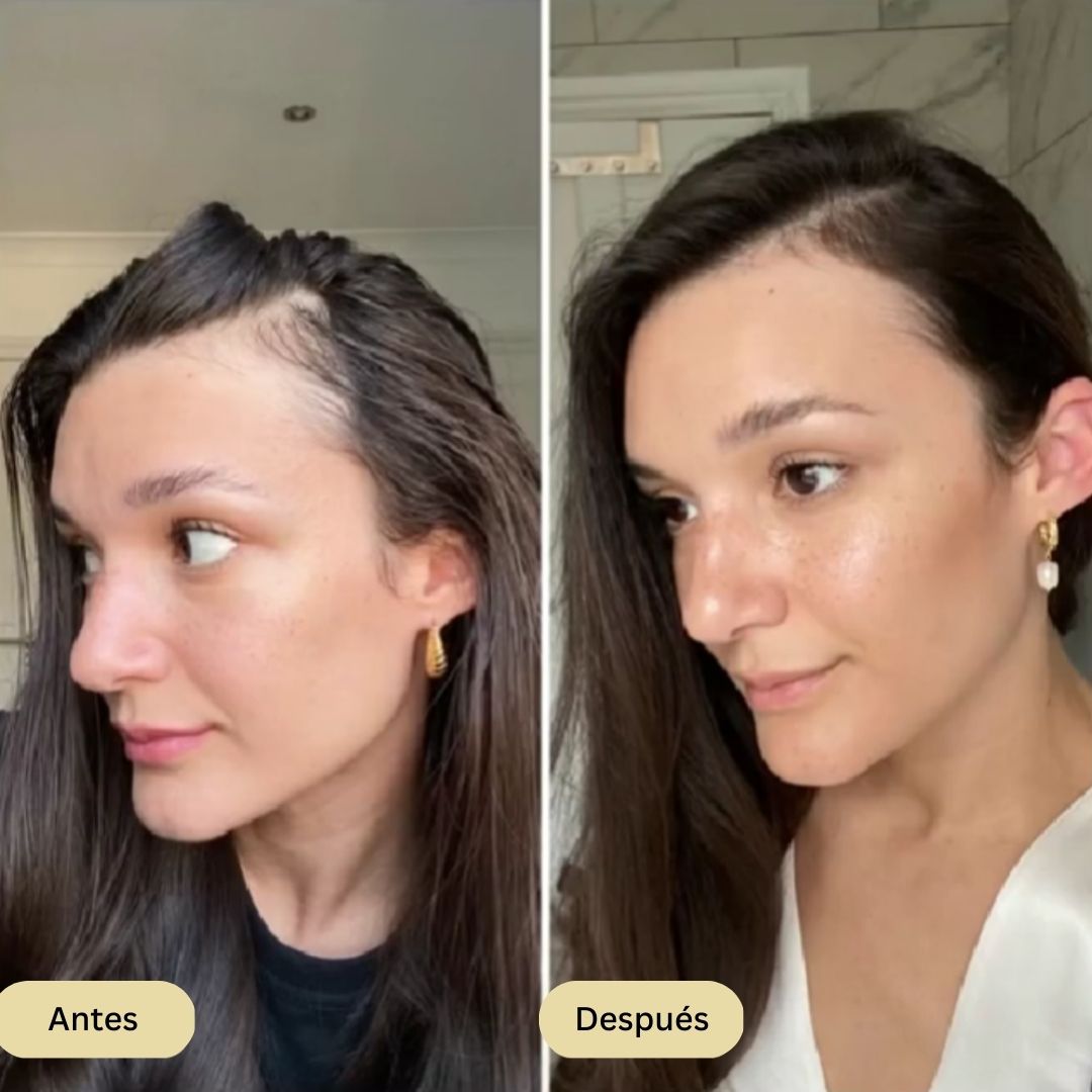 Veganic | Conseguí un Cabello más Voluminoso y Detén la Caída