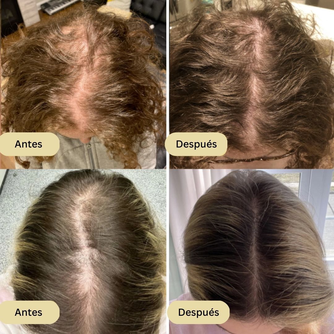 Veganic | Conseguí un Cabello más Voluminoso y Detén la Caída